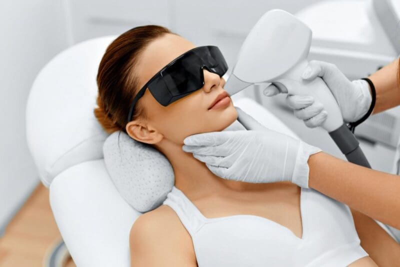 epilation-laser-visage